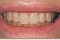 Instant Orthodontics