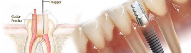 Endodontics