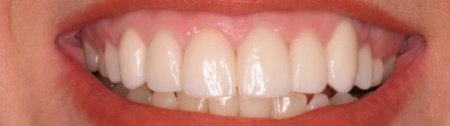 Periodontia