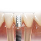 Endodontics