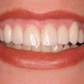 Periodontia