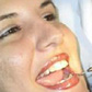 Oral and Maxillofacial Surgery