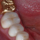 Prosthodontics 